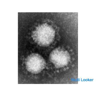 Entspricht dem neuen Coronavirus! Raumbereinigung.