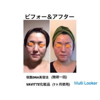 Für gesunde und schöne Haut, deren erster Eindruck sich mit der Hautentwicklung ändert