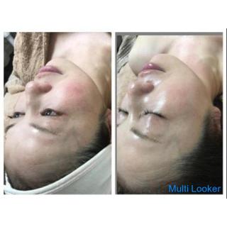 Für gesunde und schöne Haut, deren erster Eindruck sich mit der Hautentwicklung ändert