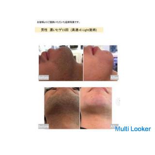 Haru Men's Hair Removal Salon