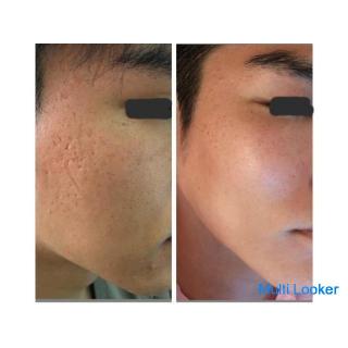 For pores / acne skin / atopic skin / spots / wrinkles / moisturized skin! A result-oriented shop wh