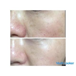 For pores / acne skin / atopic skin / spots / wrinkles / moisturized skin! A result-oriented shop wh