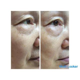 For pores / acne skin / atopic skin / spots / wrinkles / moisturized skin! A result-oriented shop wh