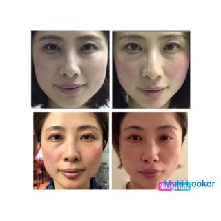 Short term! Facial muscle esthetician certification seminar