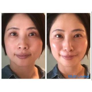 For healthy and beautiful skin whose first impression changes with skin development
