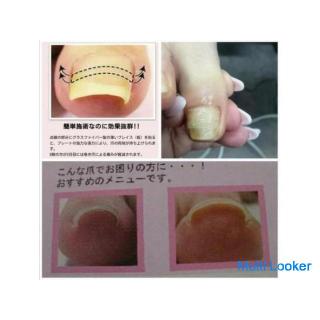 Ingrown nail correction