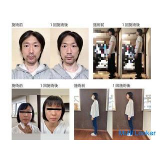 Those who have problems with stiff shoulders, low back pain, knee pain (gonarthrosis), etc.! Up to 2