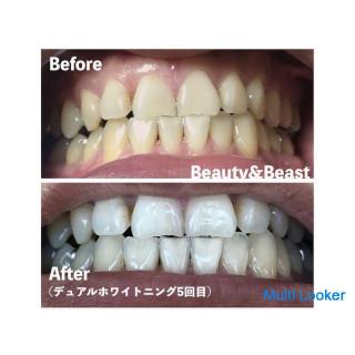 Oroku and self-whitening! Beyond traditional self-whitening!